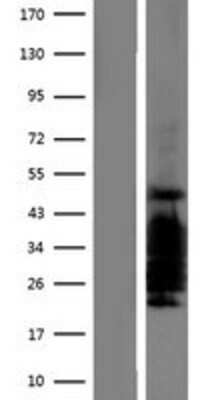 Western Blot: Cited-2 Overexpression Lysate [NBP2-07668]