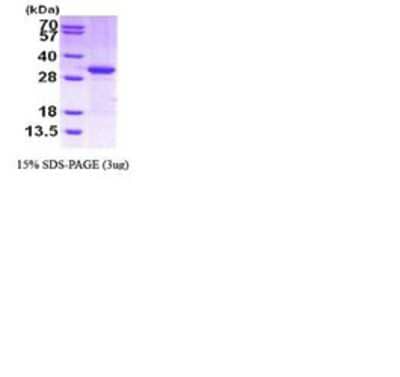 SDS-PAGE: Recombinant Human Cited-2 His Protein [NBC1-28611]