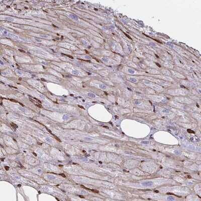 Immunohistochemistry-Paraffin: CITED4 Antibody [NBP2-33788]