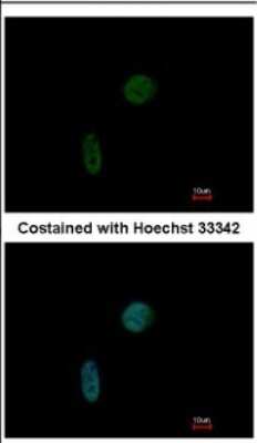 Immunocytochemistry/ Immunofluorescence: CIZ1 Antibody [NBP2-15906]