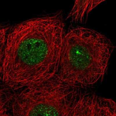 Immunocytochemistry/ Immunofluorescence: CIZ1 Antibody [NBP2-33890]