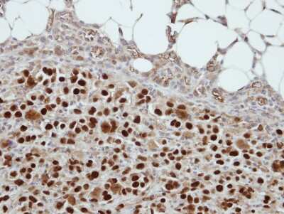 Immunohistochemistry-Paraffin: CIZ1 Antibody [NBP2-15906]