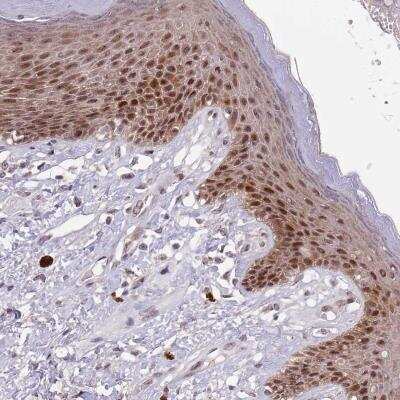 CIZ1 Antibody - BSA Free (NBP2-33890) by Novus, Part of Bio CIZ1 Antibody - BSA Free (NBP2-33890) by Novus, Part of Bio
