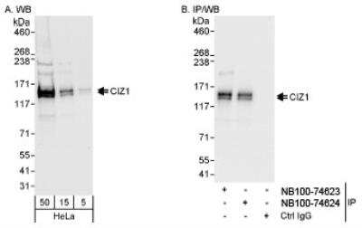 Western Blot: CIZ1 Antibody [NB100-74623]