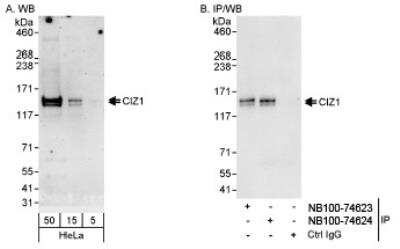 Western Blot: CIZ1 Antibody [NB100-74624]