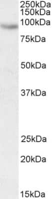 Western Blot: CIZ1 Antibody [NBP2-26207]