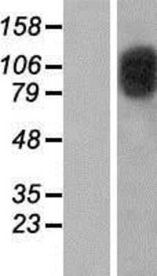 Western Blot: CIZ1 Overexpression Lysate [NBP2-07489]