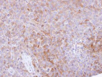Immunohistochemistry-Paraffin: CKAP1 Antibody [NBP1-33462]