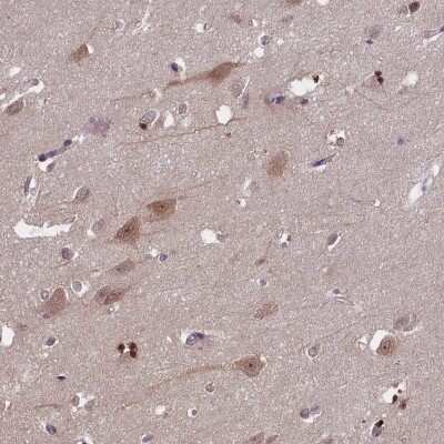 Immunohistochemistry-Paraffin: CKAP1 Antibody [NBP1-85672]