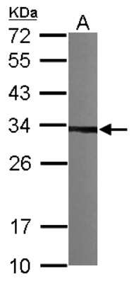 Western Blot: CKAP1 Antibody [NBP1-33462]