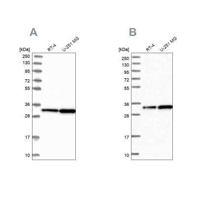 Western Blot: CKAP1 Antibody [NBP1-85672]