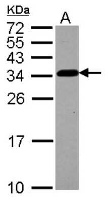 Western Blot: CKAP1 Antibody [NBP2-15907]