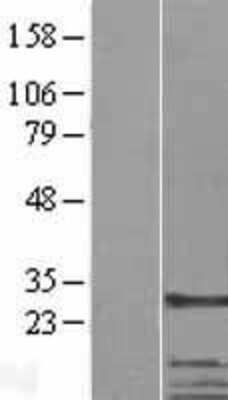 Western Blot: CKAP1 Overexpression Lysate [NBL1-16735]