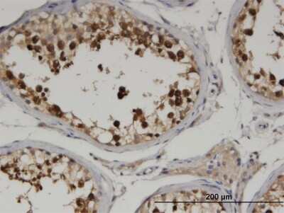 Immunohistochemistry-Paraffin: CKAP2 Antibody (3H1) [H00026586-M04]