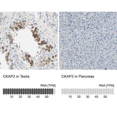 Immunohistochemistry-Paraffin: CKAP2 Antibody [NBP1-84602]