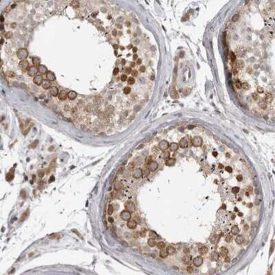 Immunohistochemistry-Paraffin: CKAP2 Antibody [NBP1-84603]