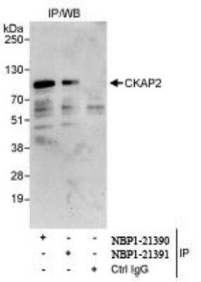 Immunoprecipitation: CKAP2 Antibody [NBP1-21390]