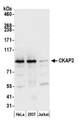 Western Blot: CKAP2 Antibody [NBP1-21391]