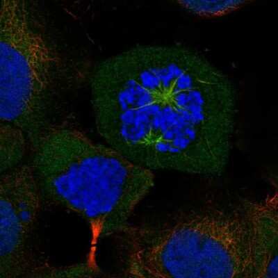 Immunocytochemistry/ Immunofluorescence: CKAP2L Antibody [NBP2-57698]
