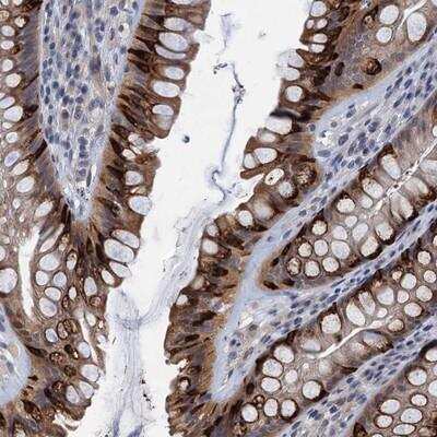 Immunohistochemistry: CKAP2L Antibody [NBP1-83451]