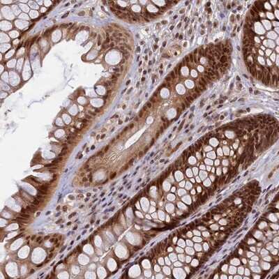 Immunohistochemistry-Paraffin: CKAP2L Antibody [NBP1-83450]