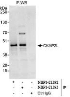 Immunoprecipitation: CKAP2L Antibody [NBP1-21392]