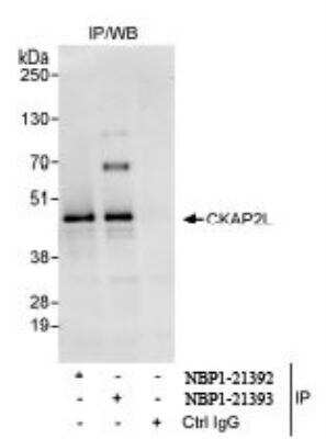 Immunoprecipitation: CKAP2L Antibody [NBP1-21393]