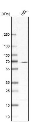 Western Blot: CKAP2L Antibody [NBP2-57698]