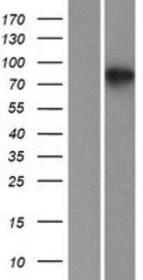 Western Blot: CKAP2L Overexpression Lysate [NBP2-05358]