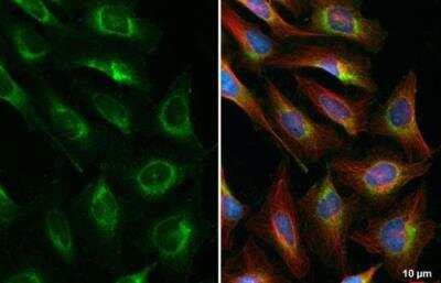 Immunocytochemistry/ Immunofluorescence: CKAP4/p63 Antibody [NBP2-15908]