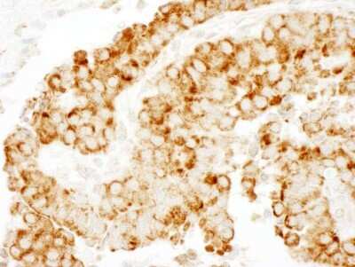 Immunohistochemistry-Paraffin: CKAP4/p63 Antibody [NBP1-26642]