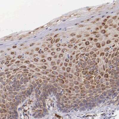Immunohistochemistry-Paraffin: CKAP4/p63 Antibody [NBP1-85571]
