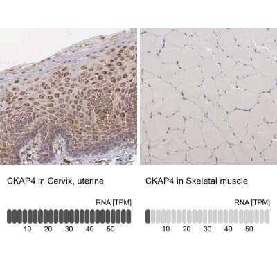 Immunohistochemistry-Paraffin: CKAP4/p63 Antibody [NBP1-85571]