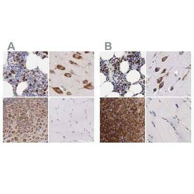 Immunohistochemistry-Paraffin: CKAP4/p63 Antibody [NBP1-85571]