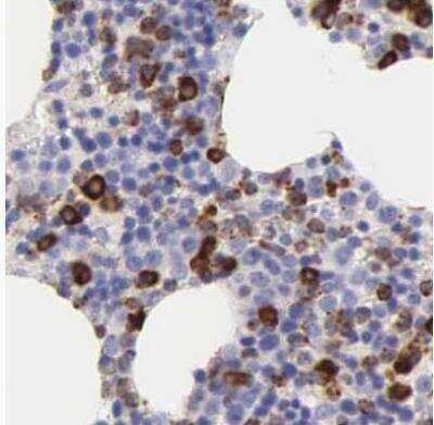 Immunohistochemistry-Paraffin: CKAP4/p63 Antibody [NBP1-85571]