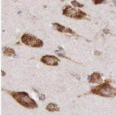 Immunohistochemistry-Paraffin: CKAP4/p63 Antibody [NBP1-85571]