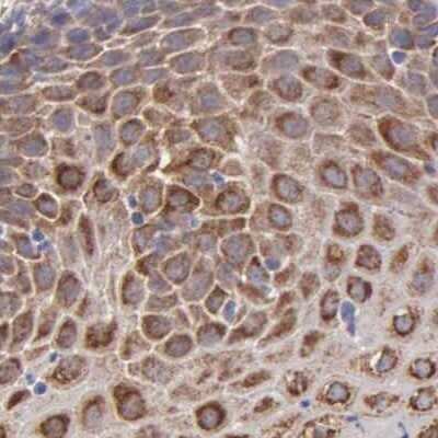 Immunohistochemistry-Paraffin: CKAP4/p63 Antibody [NBP1-85571]