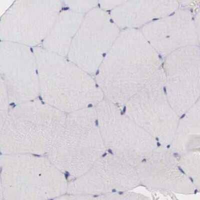 Immunohistochemistry-Paraffin: CKAP4/p63 Antibody [NBP1-85571]