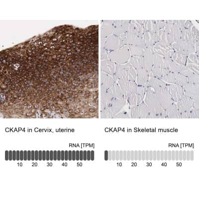 Immunohistochemistry-Paraffin: CKAP4/p63 Antibody [NBP1-85572]