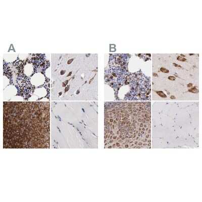 Immunohistochemistry-Paraffin: CKAP4/p63 Antibody [NBP1-85572]