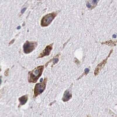 Immunohistochemistry-Paraffin: CKAP4/p63 Antibody [NBP1-85572]