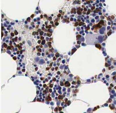 Immunohistochemistry-Paraffin: CKAP4/p63 Antibody [NBP1-85572]