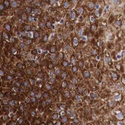 Immunohistochemistry-Paraffin: CKAP4/p63 Antibody [NBP1-85572]