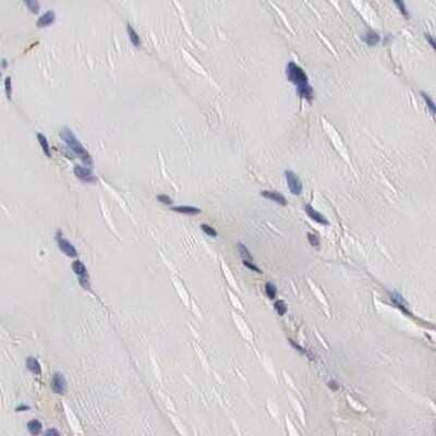 Immunohistochemistry-Paraffin: CKAP4/p63 Antibody [NBP1-85572]