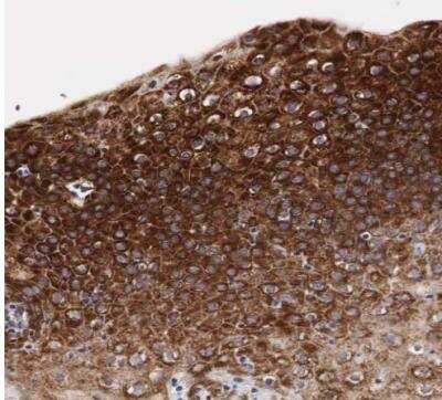 Immunohistochemistry-Paraffin: CKAP4/p63 Antibody [NBP1-85572]