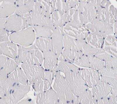 Immunohistochemistry-Paraffin: CKAP4/p63 Antibody [NBP1-85572]