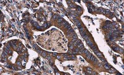 Immunohistochemistry-Paraffin: CKAP4/p63 Antibody [NBP2-15908]