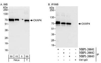 Western Blot: CKAP4/p63 Antibody [NBP1-26641]