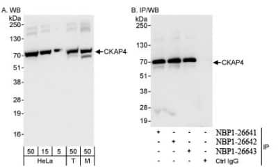 Western Blot: CKAP4/p63 Antibody [NBP1-26642]