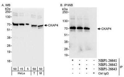 Western Blot: CKAP4/p63 Antibody [NBP1-26643]